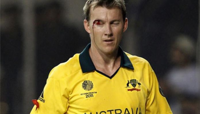 Brett Lee pics 696x398