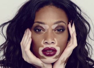 Winnie Harlow Pics