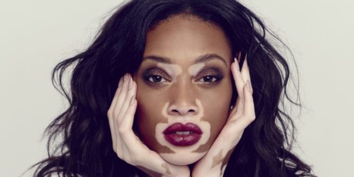 Winnie Harlow Pics 696x348